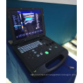 Máquina profissional do ultra-som do ecocardiography do doppler da cor 3d feita em China